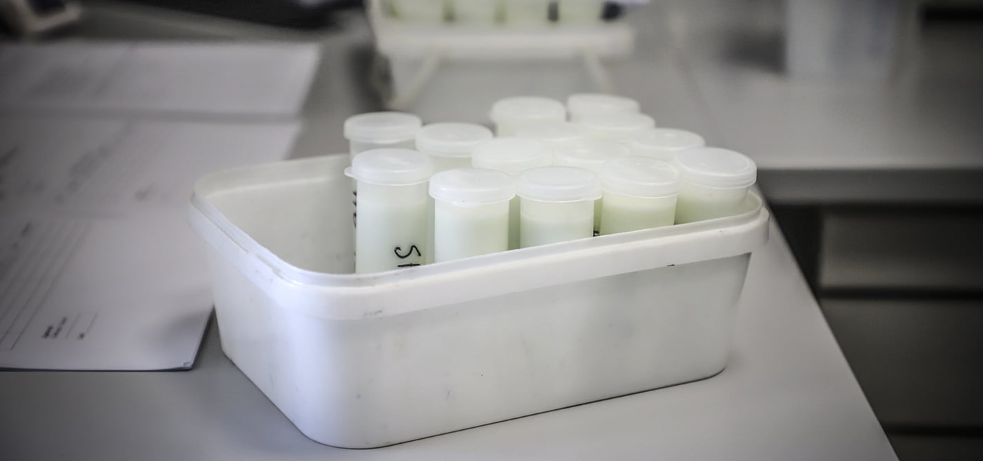 Mungesa e sigurisë ushqimore në Kosovë kërcënon shëndetin publik