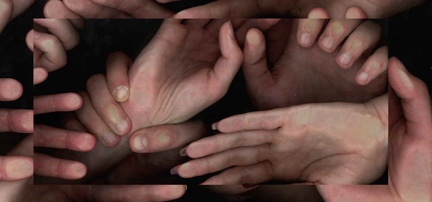 Kultura: Nezavisna ili siromašna?